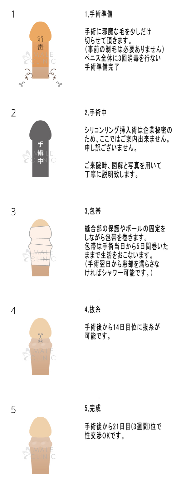 シリコンボール　ペニス 船橋中央クリニック